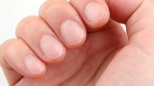 Nails Reflection Of Human Health & Personality