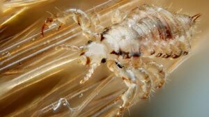 6 Easy Ways How To Prevent Lice