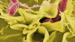 How To Prevent Salmonella: 13 Tips to Protect Your Family