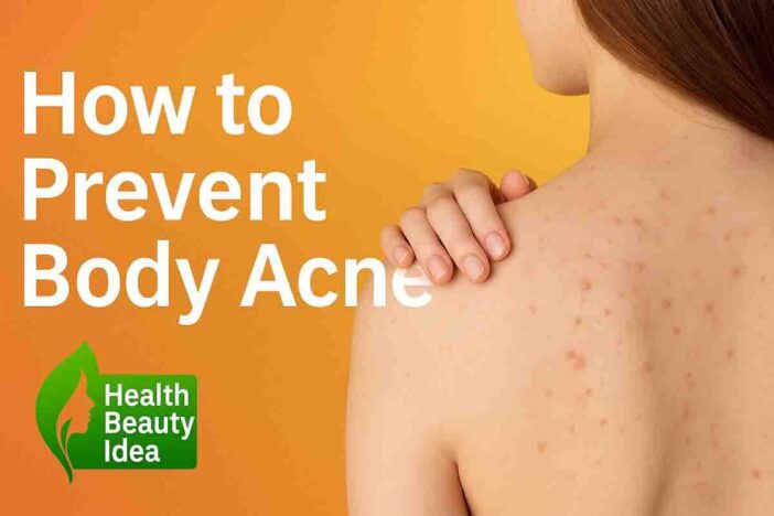 How to Prevent Body Acne