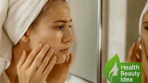 How to Prevent Cystic Acne