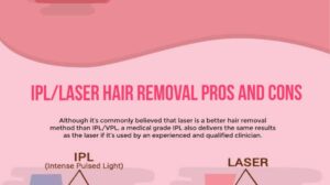 The Ultimate Guide to Laser IPL Hair Removal: Pros, Cons, and More [Infographic]
