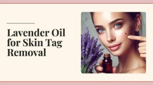 Lavender Oil for Skin Tag Removal