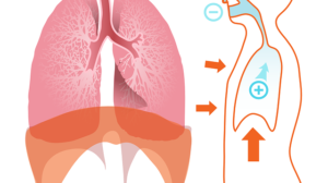 Water in Lungs: 8+ Pulmonary Edema Symptoms And Signs, Causes, How to Prevent and Treat It