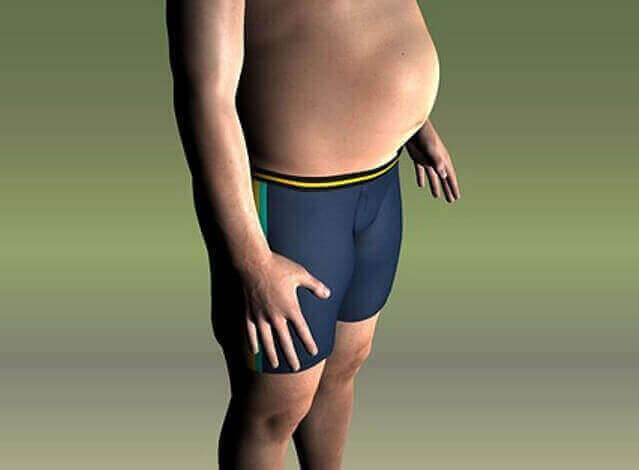 High Cholesterol Causes - Obesity