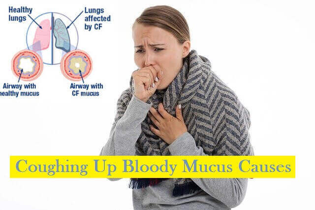 Coughing Up Bloody Mucus Causes
