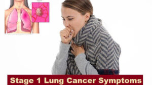 7 Stage 1 Lung Cancer Symptoms You Need To Know