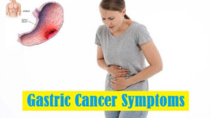 Gastric Cancer Symptoms