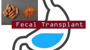 Fecal Transplant For Clostridium Difficile Infections