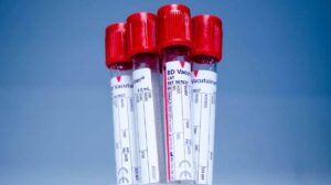 What is Hematocrit In Blood Test: Definition, and 8 Procedures