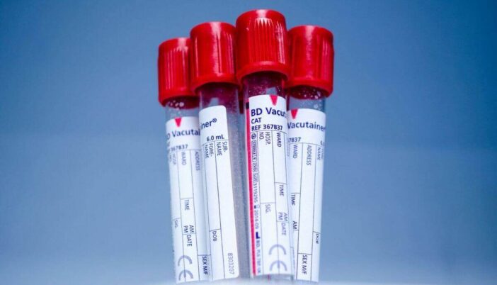 What is Hematocrit In Blood Test