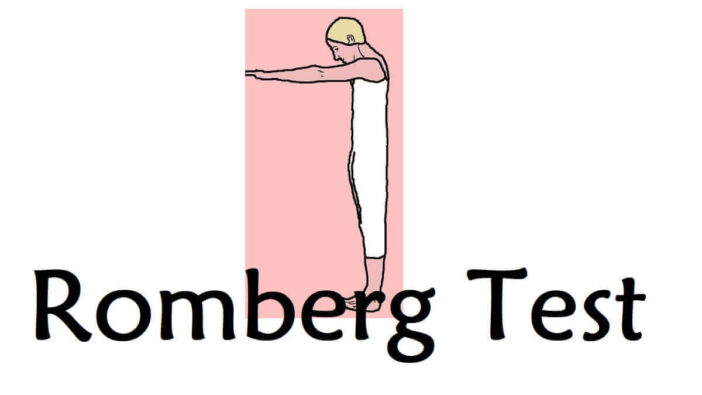 Romberg Test