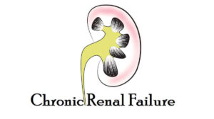 Chronic Renal Failure: Definition, 6 Risk Factors, Causes, Symptoms, and Treatment