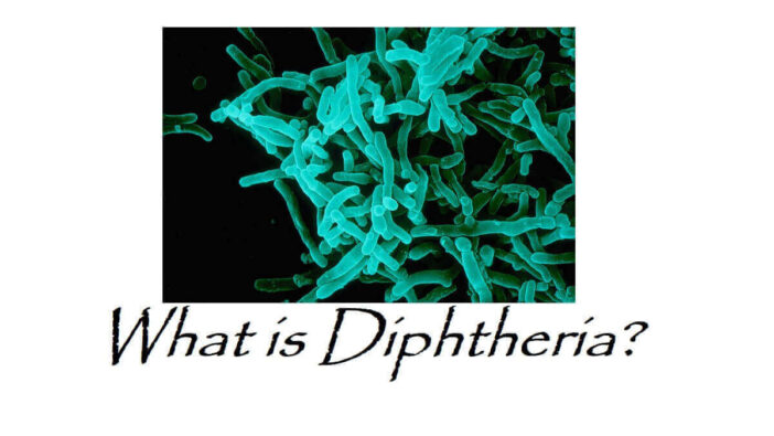 What is Diphtheria?