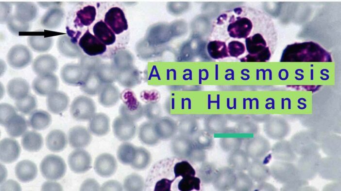 Anaplasmosis in Humans