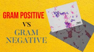 Gram Positive Vs Gram Negative Bacteria