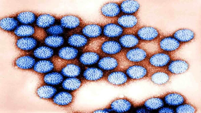 Rotavirus Symptoms