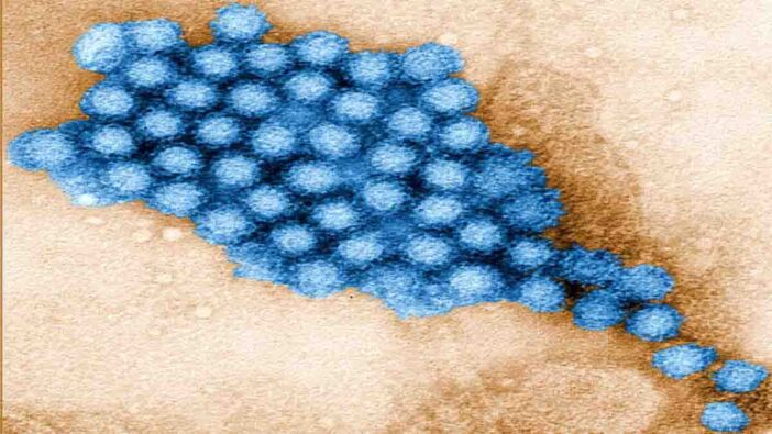 What is a Norovirus