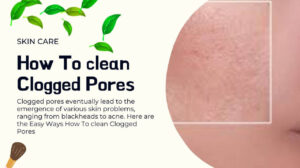 How To clean Clogged Pores