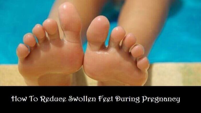 How To Reduce Swollen Feet During Pregnancy