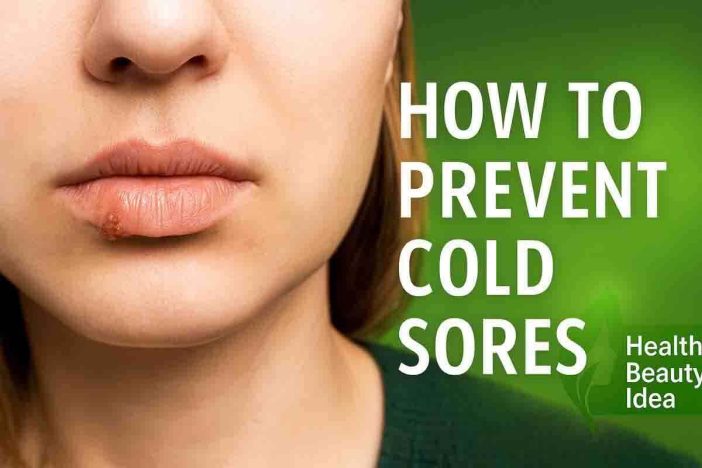 How To Prevent Cold Sores