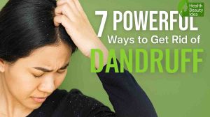 How to Get Rid of Dandruff