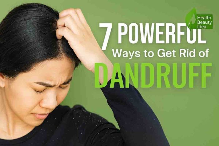 How to Get Rid of Dandruff