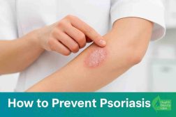 How to Prevent Psoriasis: 12 Proven Ways to Reduce Flare-Ups and Protect Your Skin